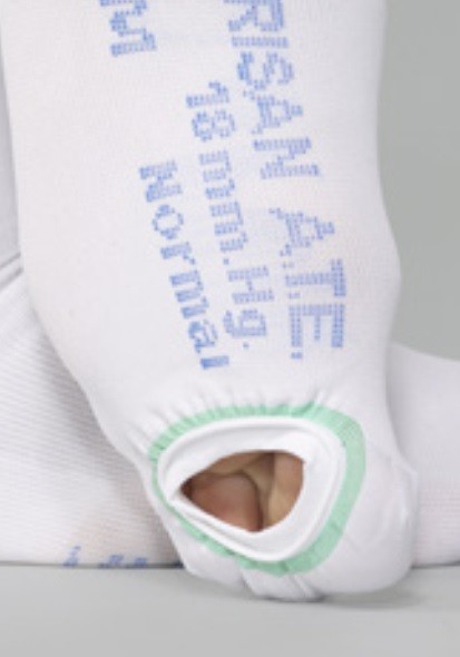 CALZE AUTOREGGENTI (AG) COTONE ANTITROMBO EMBOLICHE PUNTA CHIUSA ISPEZIONABILE 18 mmHg